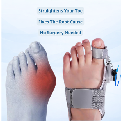 Carevia™ Bunion Fix